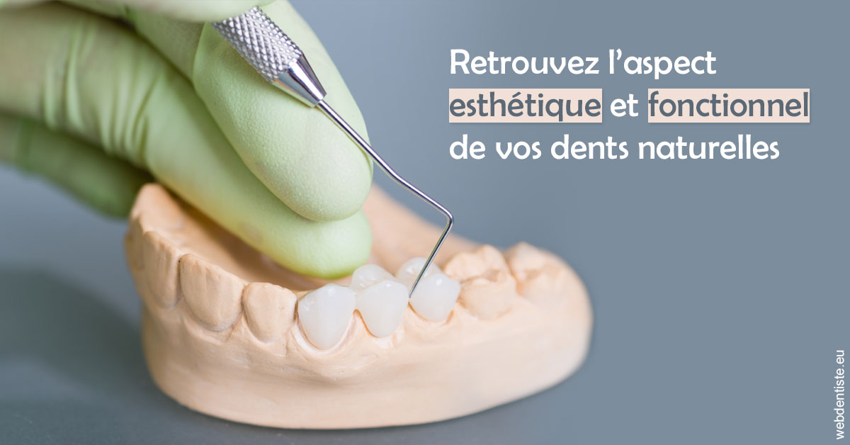 https://scp-benkimoun-lafont-roussarie.chirurgiens-dentistes.fr/Restaurations dentaires 1