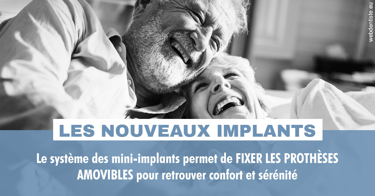 https://scp-benkimoun-lafont-roussarie.chirurgiens-dentistes.fr/Les nouveaux implants 2
