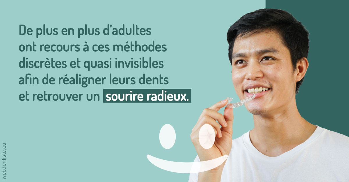 https://scp-benkimoun-lafont-roussarie.chirurgiens-dentistes.fr/Gouttières sourire radieux 2