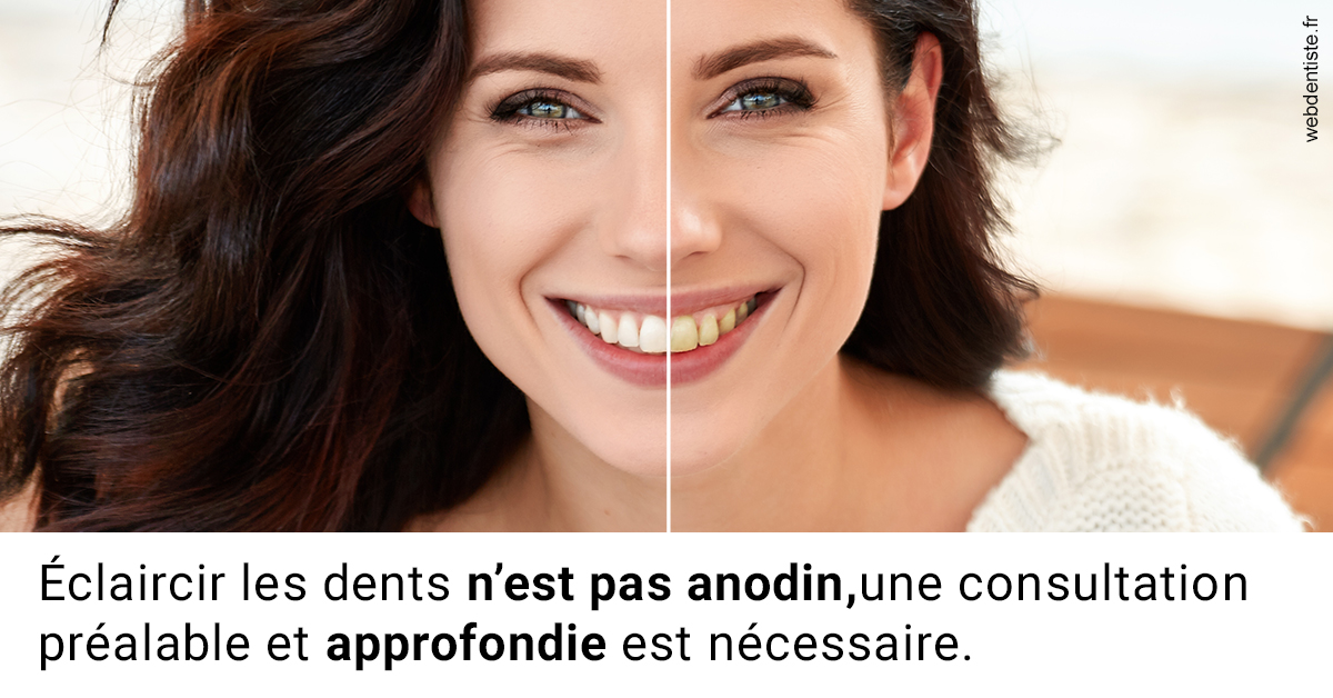 https://scp-benkimoun-lafont-roussarie.chirurgiens-dentistes.fr/Le blanchiment 2