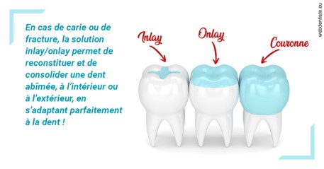 https://scp-benkimoun-lafont-roussarie.chirurgiens-dentistes.fr/L'INLAY ou l'ONLAY