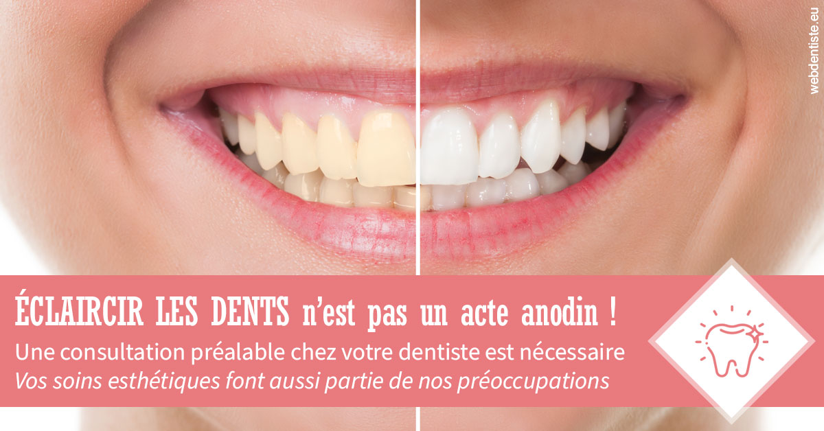 https://scp-benkimoun-lafont-roussarie.chirurgiens-dentistes.fr/Eclaircir les dents 1