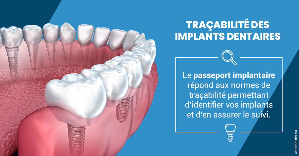 https://scp-benkimoun-lafont-roussarie.chirurgiens-dentistes.fr/T2 2023 - Traçabilité des implants 1