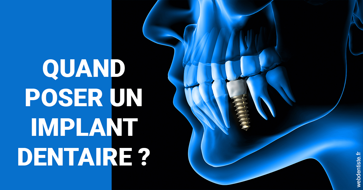 https://scp-benkimoun-lafont-roussarie.chirurgiens-dentistes.fr/Les implants 1