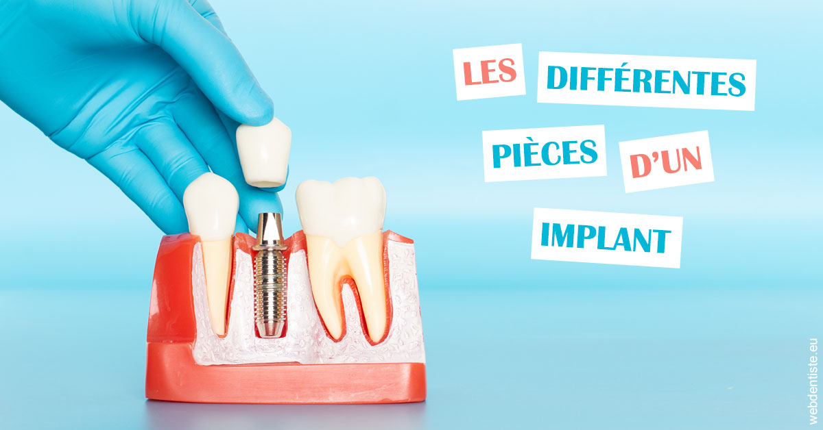 https://scp-benkimoun-lafont-roussarie.chirurgiens-dentistes.fr/Les différentes pièces d’un implant 2