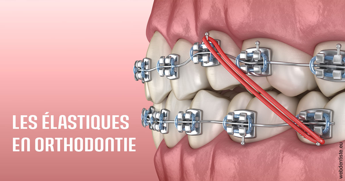 https://scp-benkimoun-lafont-roussarie.chirurgiens-dentistes.fr/Elastiques orthodontie 2
