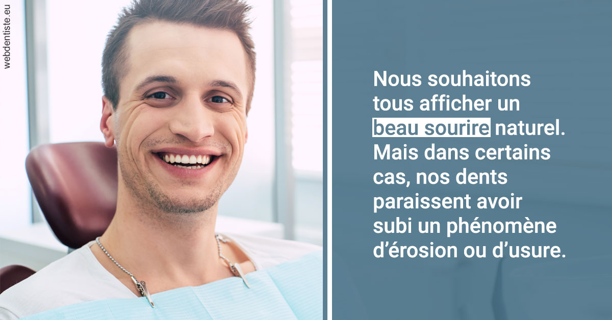 https://scp-benkimoun-lafont-roussarie.chirurgiens-dentistes.fr/Érosion et usure dentaire