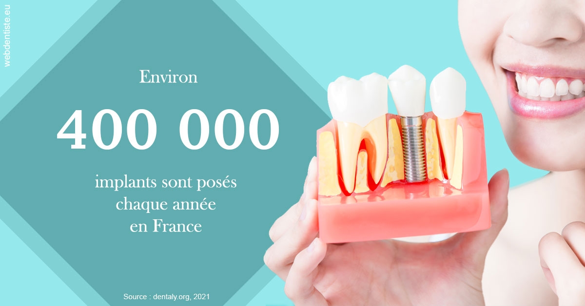 https://scp-benkimoun-lafont-roussarie.chirurgiens-dentistes.fr/Pose d'implants en France 2